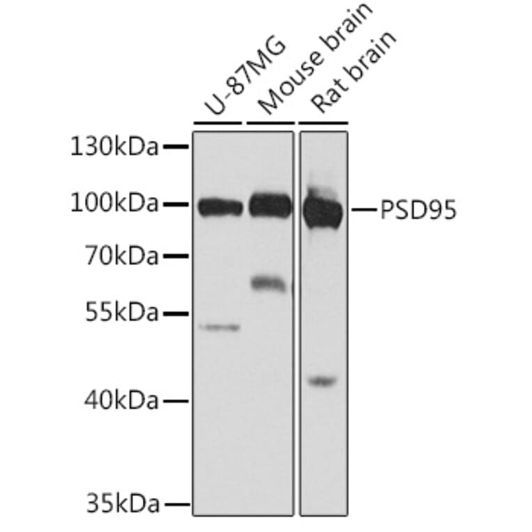 Western Blot - Anti-PSD95 Antibody (A12185) - Antibodies.com