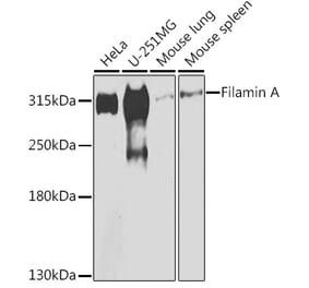 Western Blot - Anti-Filamin A Antibody (A12186) - Antibodies.com