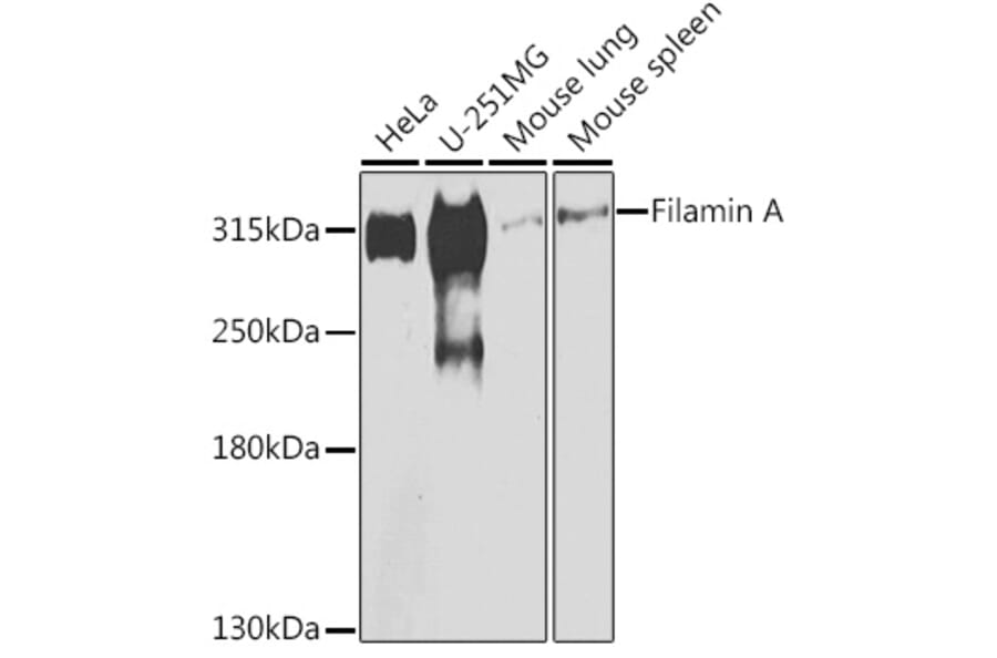 Western Blot - Anti-Filamin A Antibody (A12186) - Antibodies.com