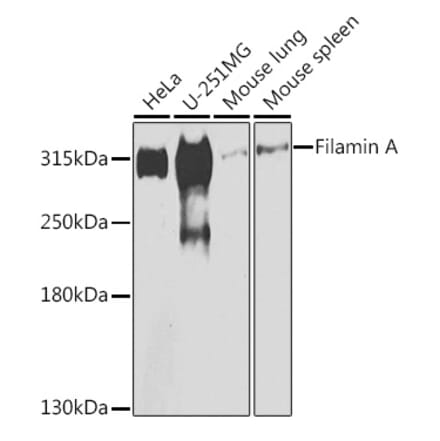 Western Blot - Anti-Filamin A Antibody (A12186) - Antibodies.com