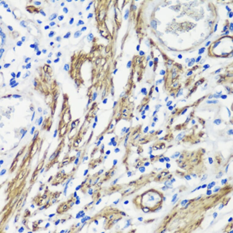 Immunohistochemistry - Anti-Filamin A Antibody (A12186) - Antibodies.com