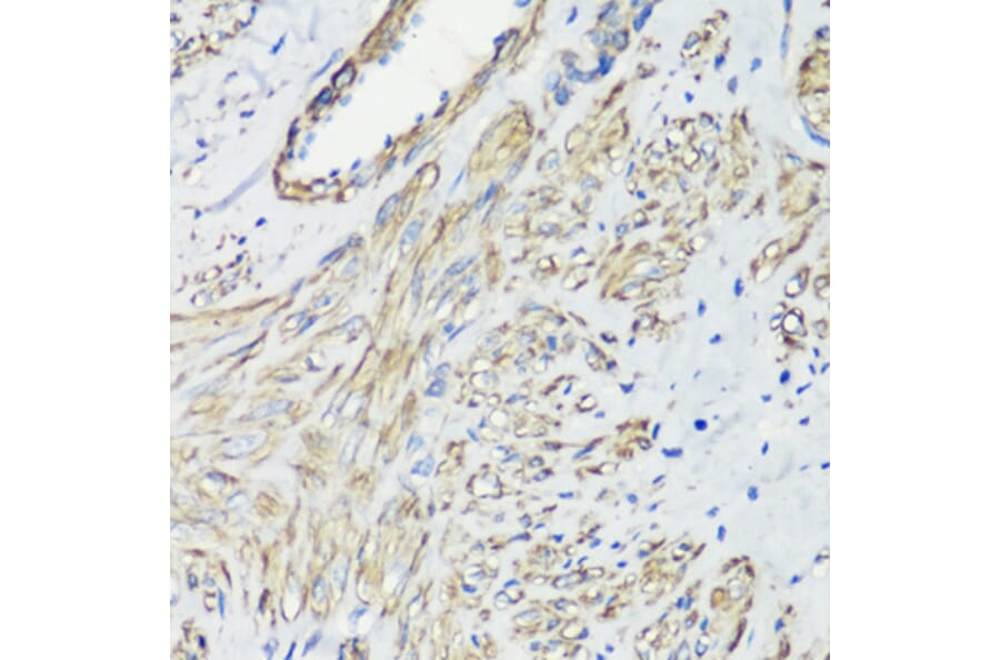 Immunohistochemistry - Anti-Filamin A Antibody (A12186) - Antibodies.com