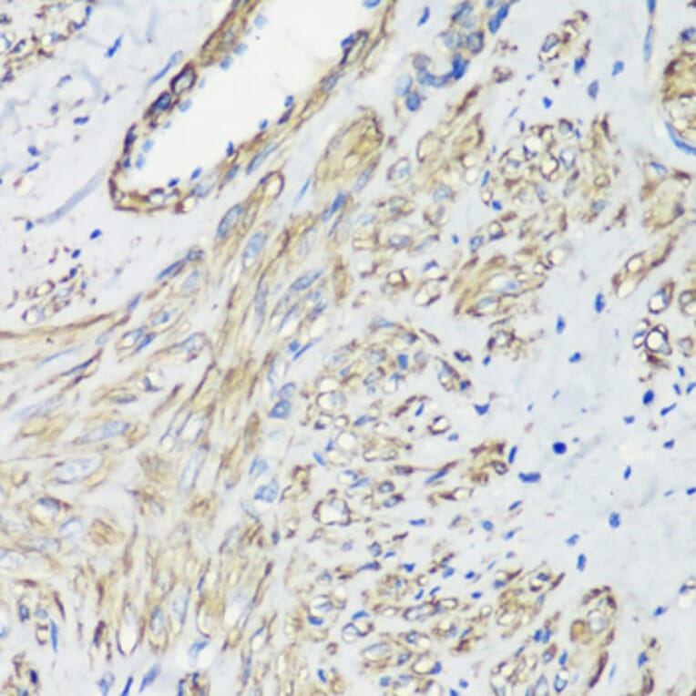 Immunohistochemistry - Anti-Filamin A Antibody (A12186) - Antibodies.com