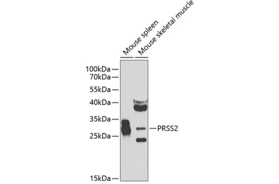 Western Blot - Anti-PRSS2 Antibody (A12187) - Antibodies.com