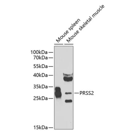 Western Blot - Anti-PRSS2 Antibody (A12187) - Antibodies.com