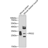 Western Blot - Anti-PRSS2 Antibody (A12187) - Antibodies.com