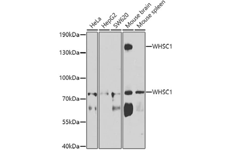 Western Blot - Anti-WHSC1/NSD2 Antibody (A12188) - Antibodies.com