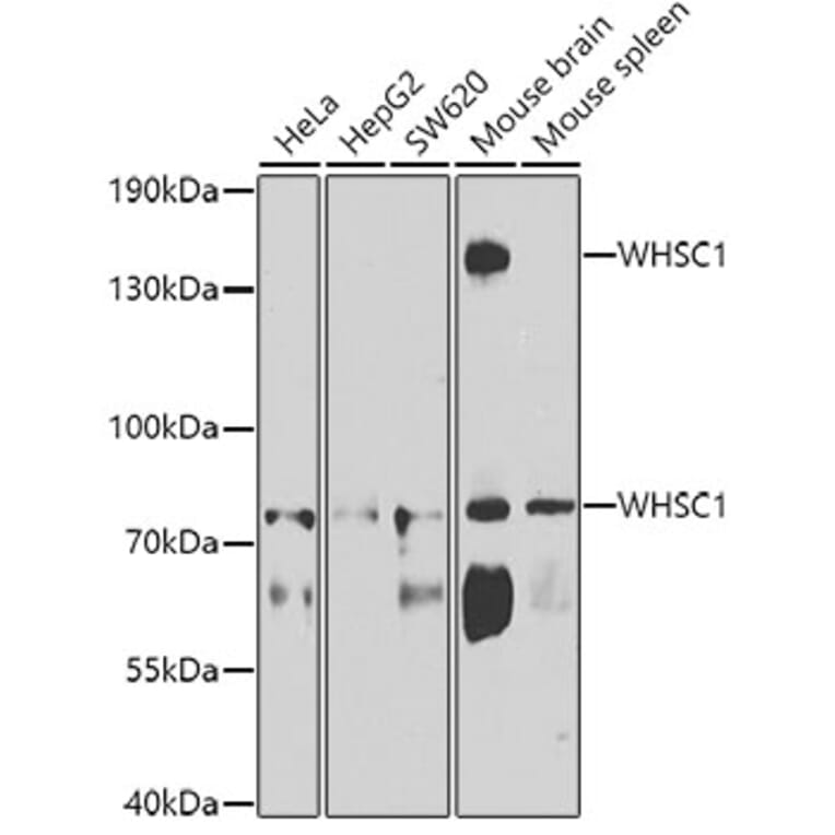 Western Blot - Anti-WHSC1/NSD2 Antibody (A12188) - Antibodies.com