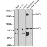 Western Blot - Anti-WHSC1/NSD2 Antibody (A12188) - Antibodies.com
