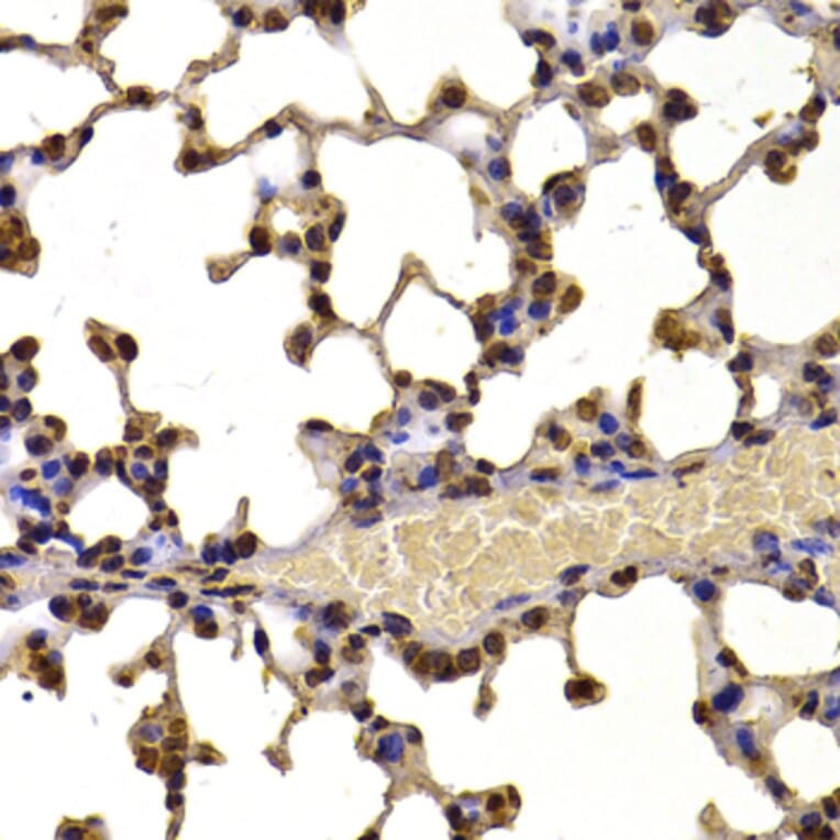 Immunohistochemistry - Anti-WHSC1/NSD2 Antibody (A12188) - Antibodies.com