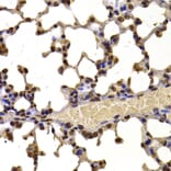 Immunohistochemistry - Anti-WHSC1/NSD2 Antibody (A12188) - Antibodies.com