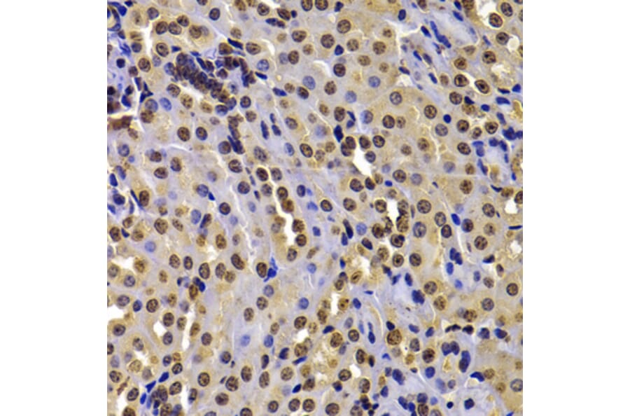 Immunohistochemistry - Anti-WHSC1/NSD2 Antibody (A12188) - Antibodies.com