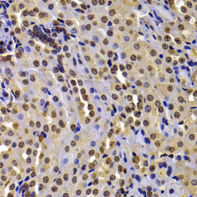 Immunohistochemistry - Anti-WHSC1/NSD2 Antibody (A12188) - Antibodies.com