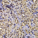 Immunohistochemistry - Anti-WHSC1/NSD2 Antibody (A12188) - Antibodies.com