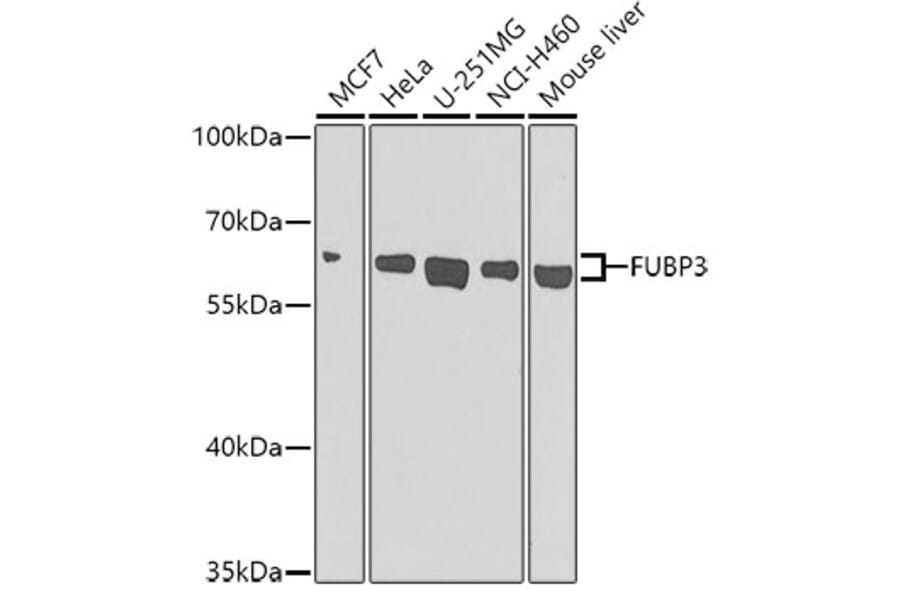 Western Blot - Anti-FUBP3 Antibody (A12189) - Antibodies.com