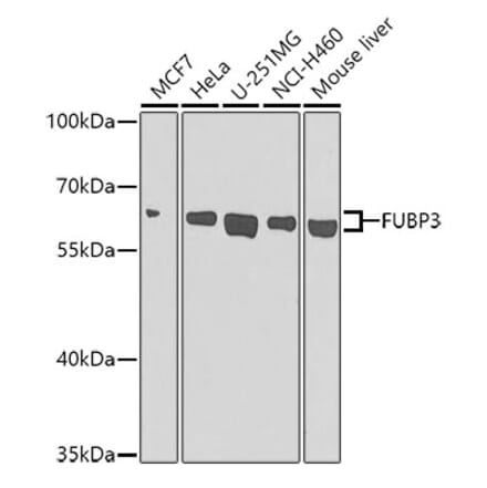 Western Blot - Anti-FUBP3 Antibody (A12189) - Antibodies.com