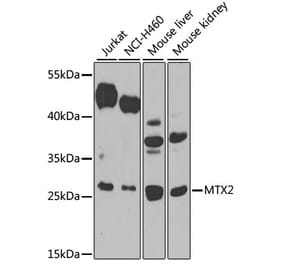 Western Blot - Anti-MTX2 Antibody (A12190) - Antibodies.com