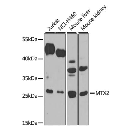 Western Blot - Anti-MTX2 Antibody (A12190) - Antibodies.com