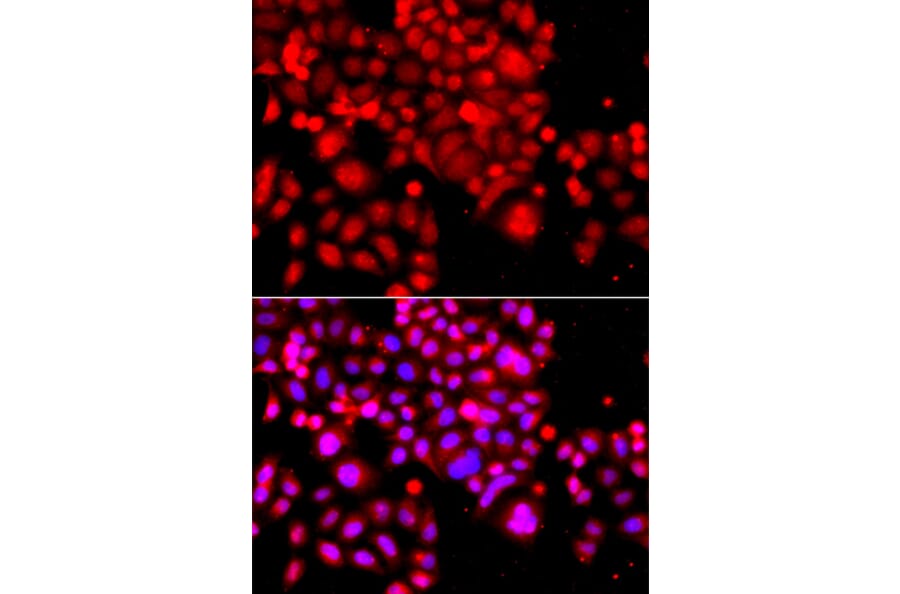 Immunofluorescence - Anti-ASCC3 Antibody (A12191) - Antibodies.com