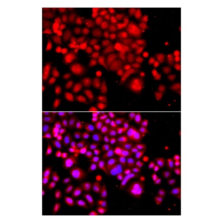 Immunofluorescence - Anti-ASCC3 Antibody (A12191) - Antibodies.com