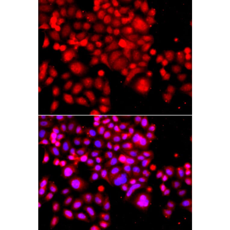 Immunofluorescence - Anti-ASCC3 Antibody (A12191) - Antibodies.com