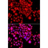 Immunofluorescence - Anti-ASCC3 Antibody (A12191) - Antibodies.com