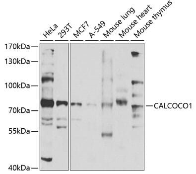 Western blot analysis of extracts of various cell lines, using Anti-CALCOCO1 Antibody (A7987) at 1:1,000 dilution. Secondary antibody: Goat Anti-Rabbit IgG (H+L) (HRP) (AS014) at 1:10,000 dilution. Lysates / proteins: 25µg per lane. Blocking buffer: 3% non-fat dry milk in TBST. Detection: ECL Enhanced Kit (RM00021). Exposure time: 90s.