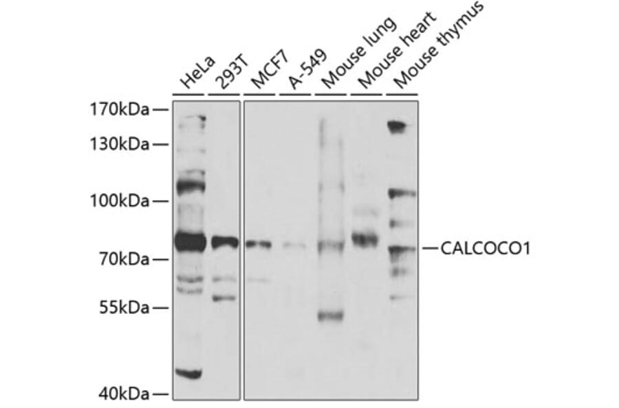 Western Blot - Anti-CoCoA Antibody (A12192) - Antibodies.com