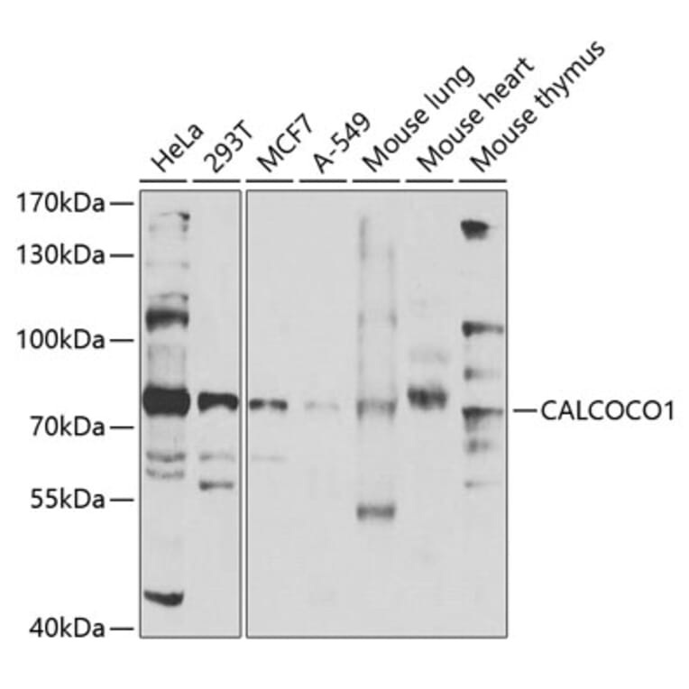 Western Blot - Anti-CoCoA Antibody (A12192) - Antibodies.com