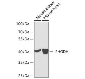 Western Blot - Anti-L2HGDH Antibody (A12193) - Antibodies.com