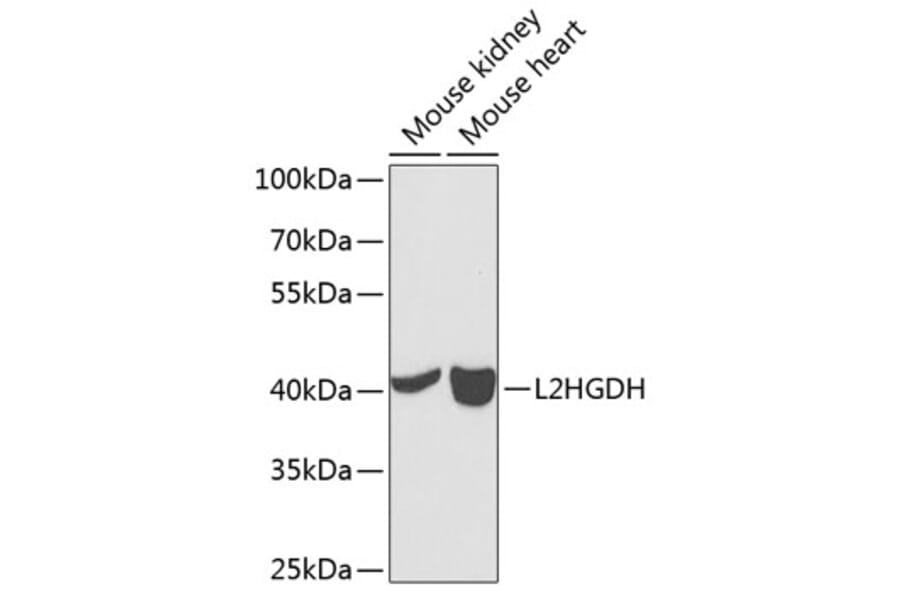 Western Blot - Anti-L2HGDH Antibody (A12193) - Antibodies.com