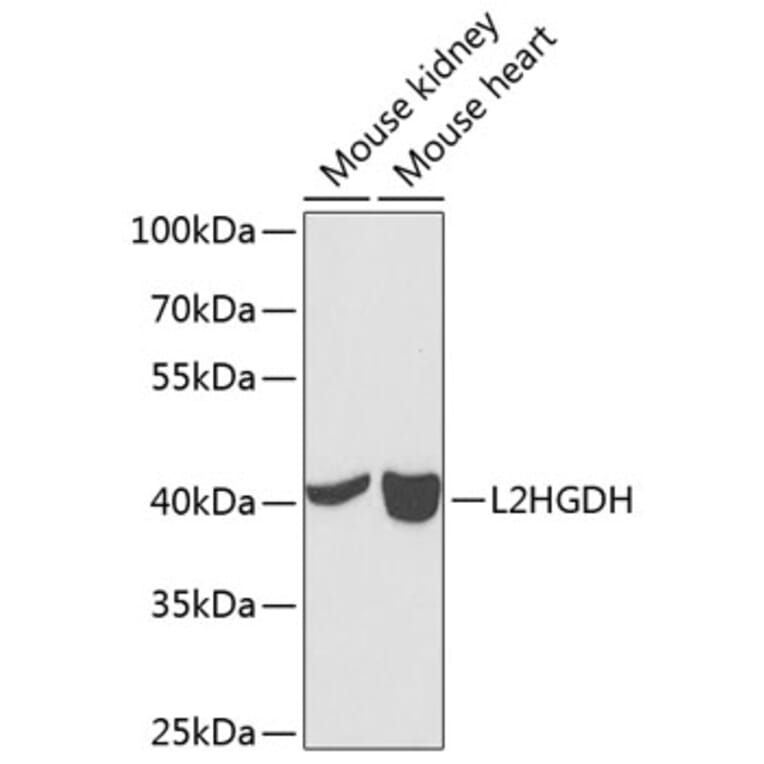 Western Blot - Anti-L2HGDH Antibody (A12193) - Antibodies.com