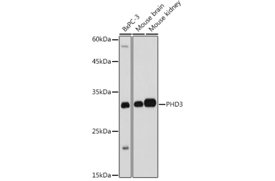 Western Blot - Anti-PHD3 Antibody (A12194) - Antibodies.com
