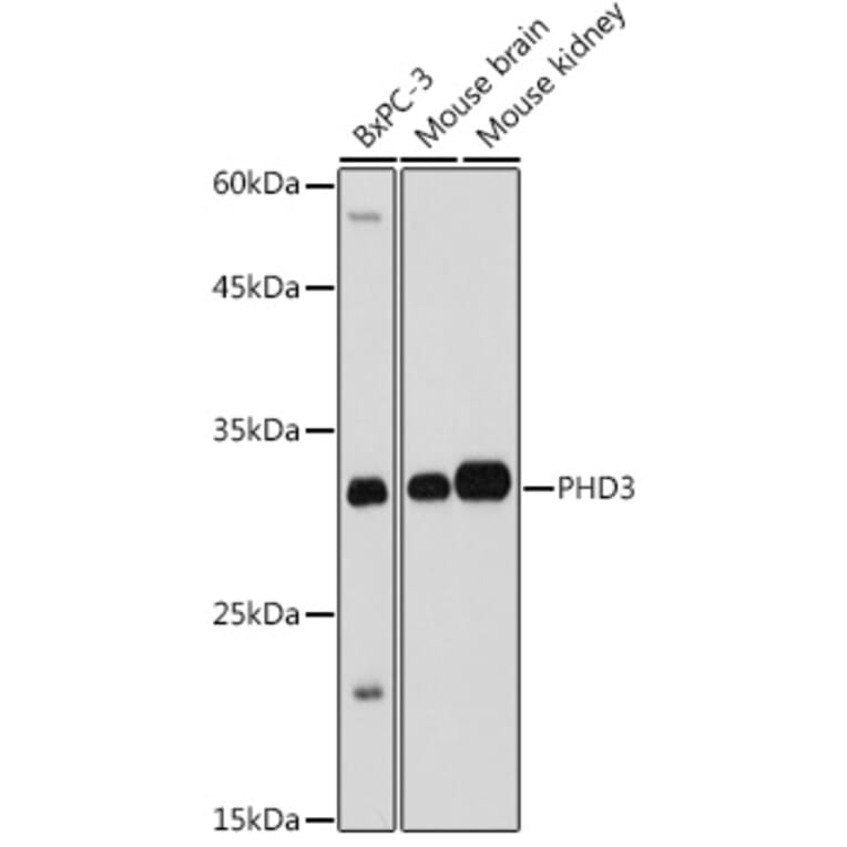 Western Blot - Anti-PHD3 Antibody (A12194) - Antibodies.com