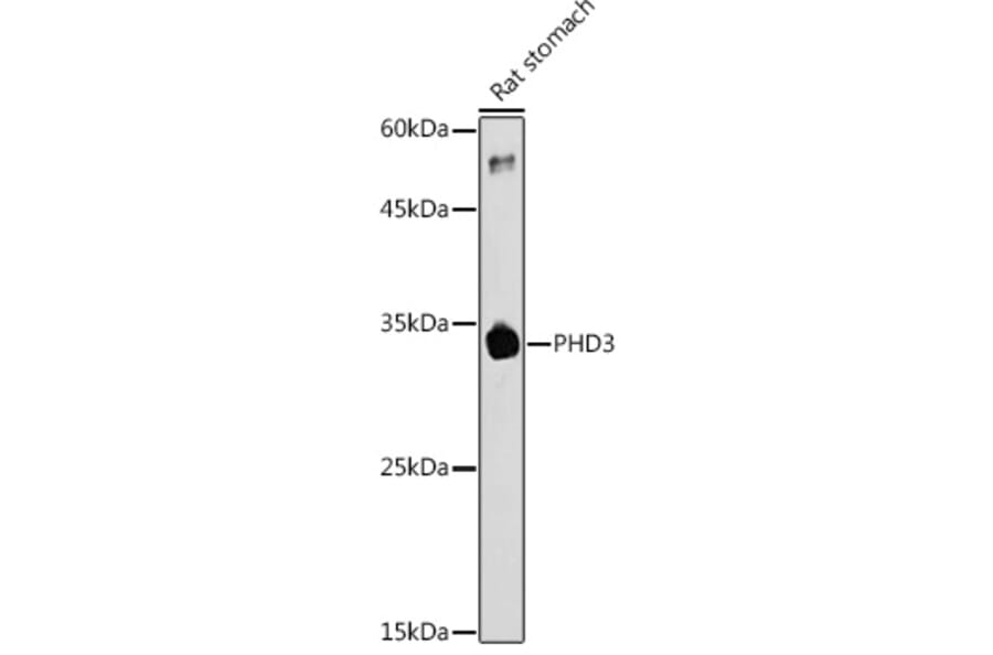 Western Blot - Anti-PHD3 Antibody (A12194) - Antibodies.com