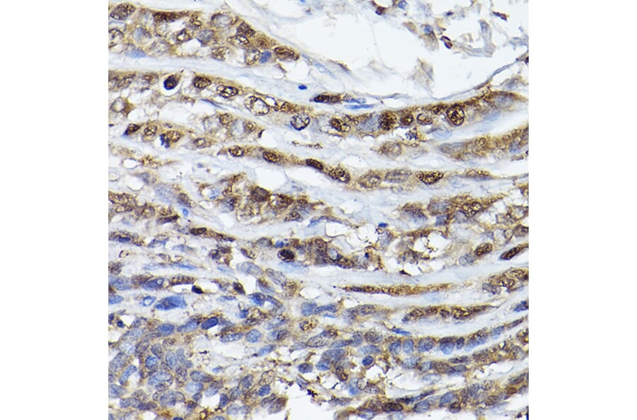 Immunohistochemistry - Anti-PHD3 Antibody (A12194) - Antibodies.com