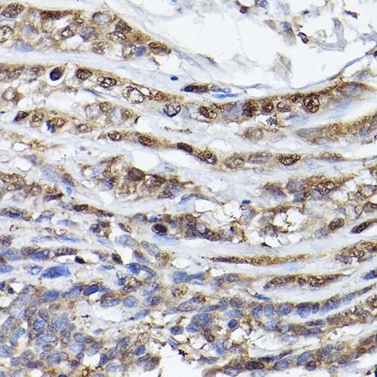 Immunohistochemistry - Anti-PHD3 Antibody (A12194) - Antibodies.com
