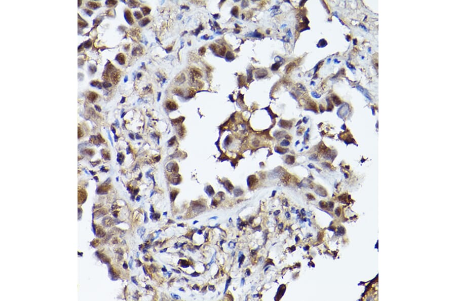 Immunohistochemistry - Anti-PHD3 Antibody (A12194) - Antibodies.com