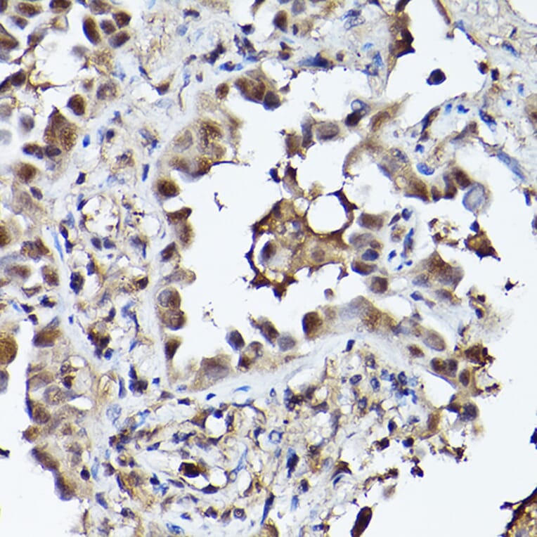 Immunohistochemistry - Anti-PHD3 Antibody (A12194) - Antibodies.com