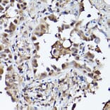 Immunohistochemistry - Anti-PHD3 Antibody (A12194) - Antibodies.com