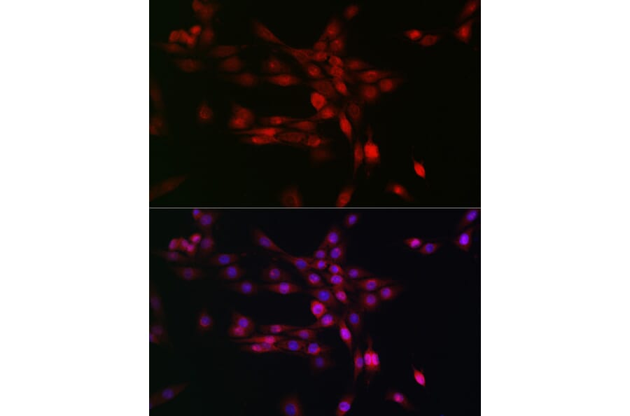 Immunofluorescence - Anti-PHD3 Antibody (A12194) - Antibodies.com