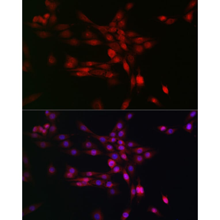 Immunofluorescence - Anti-PHD3 Antibody (A12194) - Antibodies.com