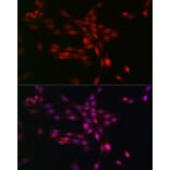 Immunofluorescence - Anti-PHD3 Antibody (A12194) - Antibodies.com
