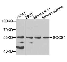 Western Blot - Anti-SOCS4 Antibody (A8003) - Antibodies.com