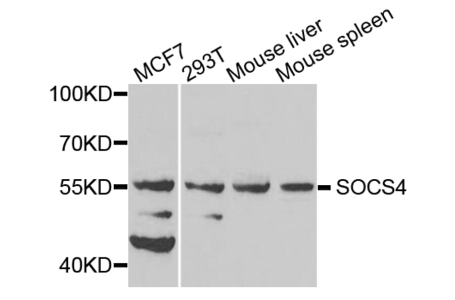 Western Blot - Anti-SOCS4 Antibody (A8003) - Antibodies.com