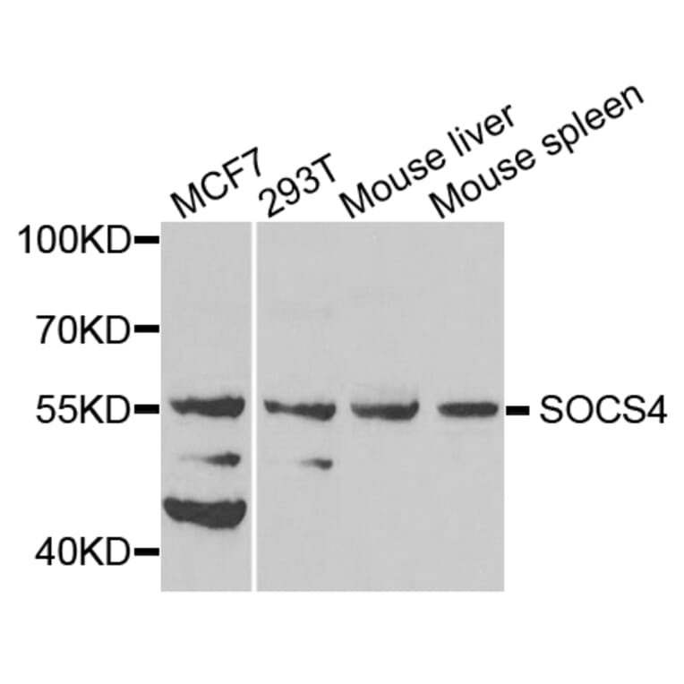 Western Blot - Anti-SOCS4 Antibody (A8003) - Antibodies.com