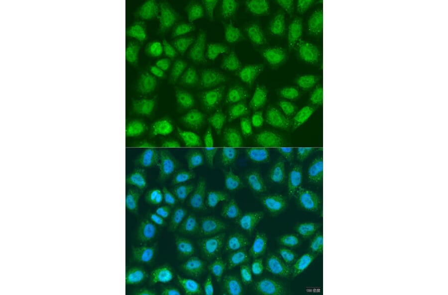 Immunofluorescence - Anti-SOCS4 Antibody (A8003) - Antibodies.com