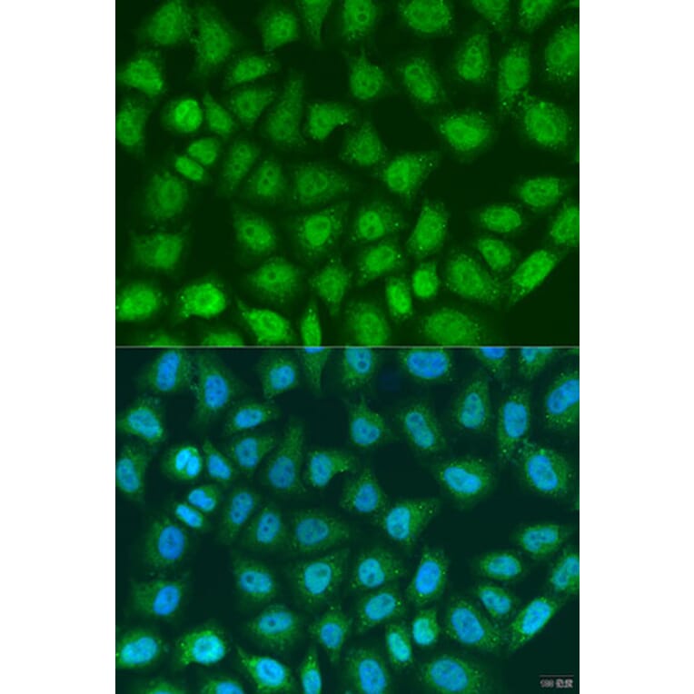 Immunofluorescence - Anti-SOCS4 Antibody (A8003) - Antibodies.com