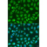 Immunofluorescence - Anti-SOCS4 Antibody (A8003) - Antibodies.com