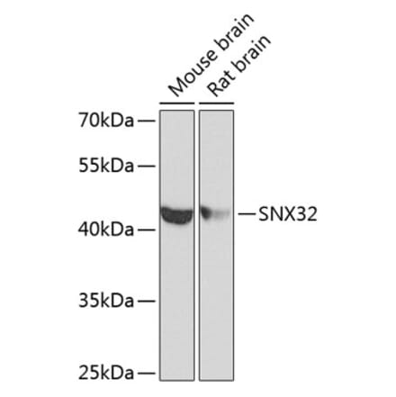 Western Blot - Anti-FLJ30934 Antibody (A12197) - Antibodies.com
